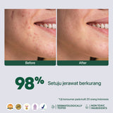 NPURE ACNE SPOT TREATMENT 20GR