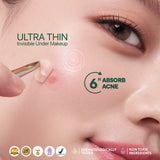 【NEW LAUNCH】NPURE ACNE CLEAR PATCH ISI 18pcs / Patch Jerawat / Acne Skin