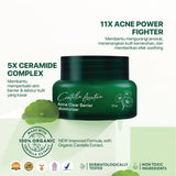 NPURE Paket Face Wash + Toner Cica 150ml + Cica Moisturizer (Cica / Acne Series)