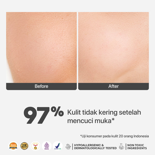 Bundling 3 pcs Noni Cleanser 50ML