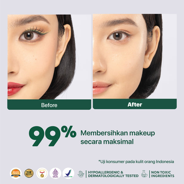 NPURE ACNE POWER CLEAR MICELLAR WATER 100ml