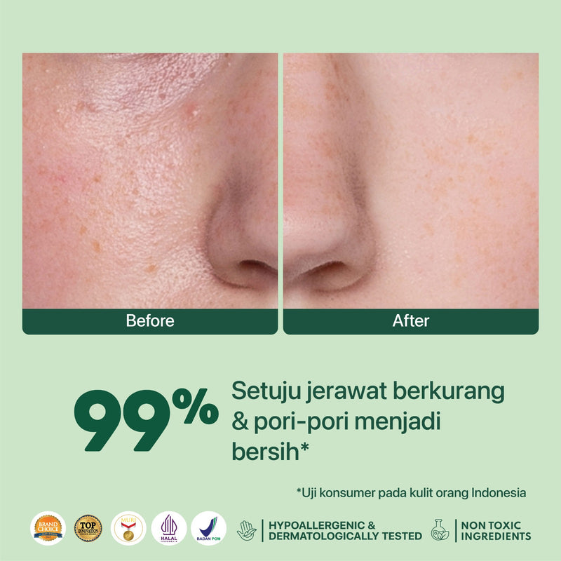 NPURE Acne Face toner Centella Asiatica 150ml