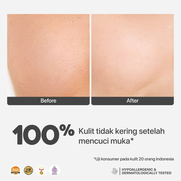 NPURE Noni Hypoallergenic Gentle Gel Cleanser 100ml