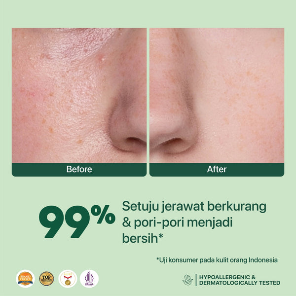 NPURE 30ML Face Toner Centella Asiatica (Cica Series)