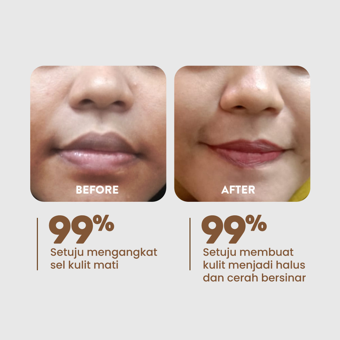 Jual NPURE Licorice Light Up Brightening Pad Npure Official